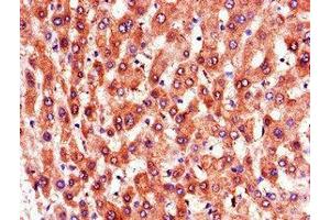 Immunohistochemistry (IHC) image for anti-Prostaglandin Reductase 1 (PTGR1) (AA 202-282) antibody (ABIN7164866)