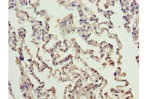 Immunohistochemistry of paraffin-embedded human lung tissue using ABIN7150172 at dilution of 1:100 (ERCC6L2 Antikörper  (AA 72-371))