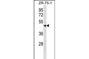 VN1R5 Antibody (Center) (ABIN1538092 and ABIN2849758) western blot analysis in ZR-75-1 cell line lysates (35 μg/lane). (VN1R5 Antikörper  (AA 214-241))