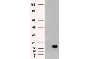 HEK293T cells were transfected with the pCMV6-ENTRY control (Left lane) or pCMV6-ENTRY AK1 (Right lane) cDNA for 48 hrs and lysed. (Adenylate Kinase 1 Antikörper)