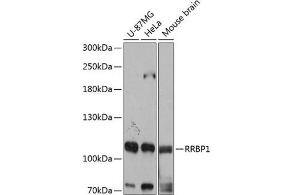 RRBP1 Antikörper  (AA 1-140)