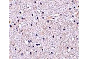 Immunohistochemistry (IHC) image for anti-Nicastrin (NCSTN) (C-Term) antibody (ABIN1030543) (Nicastrin Antikörper  (C-Term))