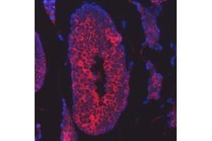 IF analysis of TTLL2 using anti-TTLL2 antibody (ABIN7600850).