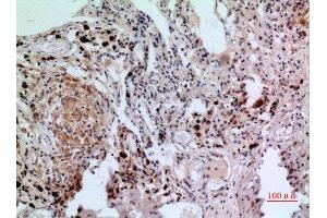 Immunohistochemistry (IHC) image for anti-Nuclear Factor of Activated T-Cells, Cytoplasmic, Calcineurin-Dependent 1 (NFATC1) (C-Term) antibody (ABIN3187889)