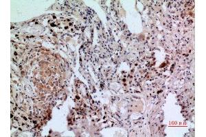 Immunohistochemistry (IHC) analysis of paraffin-embedded Human Lung, antibody was diluted at 1:100. (NFATC1 Antikörper  (C-Term))