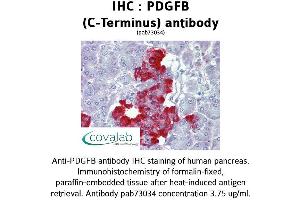 Image no. 1 for anti-Platelet Derived Growth Factor Subunit B (PDGFB) (C-Term) antibody (ABIN1737934) (PDGFB Antikörper  (C-Term))
