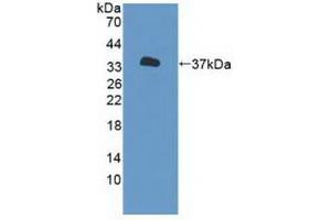 Detection of Recombinant P2RX7, Human using Polyclonal Antibody to Purinergic Receptor P2X, Ligand Gated Ion Channel 7 (P2RX7) (P2RX7 Antikörper  (AA 47-334))