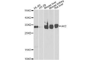 Western blot analysis of extracts of various cell lines, using AK2 antibody (ABIN2560999) at 1:1000 dilution. (Adenylate Kinase 2 Antikörper)