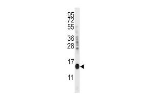 Western blot analysis of anti-CDA Antibody (C-term) (ABIN389393 and ABIN2839485) in mouse kidney tissue lysates (35 μg/lane).