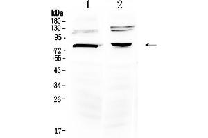 Western blot analysis of Dishevelled 3 using anti- Dishevelled 3 antibody .