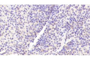 Immunohistochemistry (IHC) image for anti-Golgi Membrane Protein 1 (GOLM1) (AA 119-223) antibody (ABIN7433906)