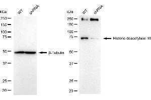 Western blotting analysis using histone deacetylase 10 antibody (ABIN7798926). (Rekombinanter HDAC10 Antikörper)