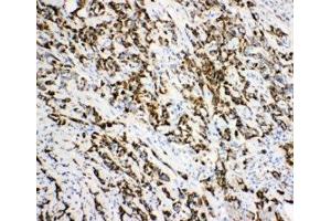 Immunohistochemistry (IHC) image for anti-Enoyl-CoA Delta Isomerase 1 (ECI1) (C-Term) antibody (ABIN3030698)