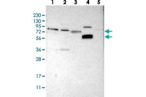 Western blot analysis of Lane 1: RT-4, Lane 2: U-251 MG, Lane 3: Human Plasma, Lane 4: Liver, Lane 5: Tonsil with FRRS1 polyclonal antibody . (Ferric-Chelate Reductase 1 (FRRS1) Antikörper)