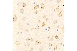 Immunohistochemistry analysis of paraffin-embedded mouse brain using,Arp2 (ABIN7072895) at dilution of 1: 800