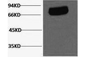 Western Blotting (WB) image for anti-Transferrin (TF) antibody (ABIN5962683) (Transferrin Antikörper)