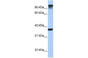 WB Suggested Anti-EPS15 Antibody Titration: 0. (EPS15 Antikörper  (C-Term))