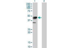 Calreticulin 3 Antikörper  (AA 21-384)