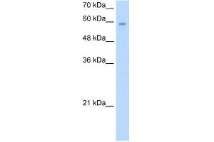 Human Jurkat; WB Suggested Anti-ARIH2 Antibody Titration: 2. (ARIH2 Antikörper  (N-Term))