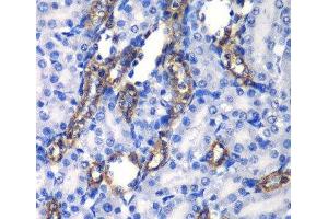 Immunohistochemistry of paraffin-embedded Rat kidney using MATK Polyclonal Antibody at dilution of 1:100 (40x lens). (MATK Antikörper)