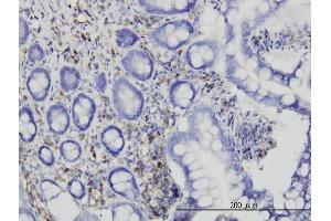 Immunoperoxidase of monoclonal antibody to RASA1 on formalin-fixed paraffin-embedded human small Intestine.