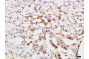 Formalin-fixed and paraffin embedded rat liver labeled with Anti-P450 1A2/CYP1A2 Polyclonal Antibody, Unconjugated (ABIN742470) at 1:200 followed by conjugation to the secondary antibody and DAB staining