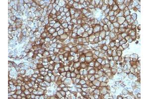 Image no. 1 for anti-Melanoma Marker antibody (ABIN6157176)