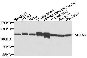 Western blot analysis of extracts of various cell lines, using ACTN2 antibody. (ACTN2 Antikörper  (AA 1-250))