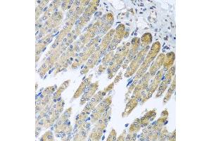 Immunohistochemistry of paraffin-embedded mouse stomach using NDUFB10 antibody at dilution of 1:100 (x40 lens). (NDUFB10 Antikörper)