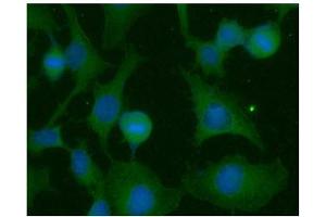 ICC/IF analysis of RAS in HeLa cells line, stained with DAPI (Blue) for nucleus staining and monoclonal anti-human RAS antibody (1:100) with goat anti-mouse IgG-Alexa fluor 488 conjugate (Green). (RAS Antikörper  (AA 1-186))