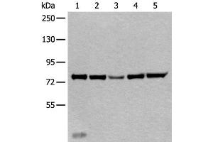 Western blot analysis of Mouse liver tissue Hela cell Human testis tissue Jurkat and HEPG2 cell lysates using ATF6B Polyclonal Antibody at dilution of 1:300 (ATF6B Antikörper)