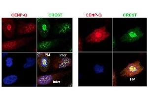 Immunofluorescence microscopy using  protein A purified anti-CENP-Q antibody shows detection of endogenous CENP-Q in HeLa whole cell lysate. (CENPQ Antikörper)