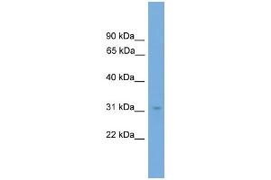 WB Suggested Anti-NRBF2  Antibody Titration: 0. (NRBF2 Antikörper  (N-Term))