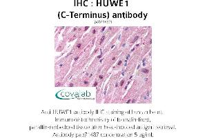 Image no. 1 for anti-HECT, UBA and WWE Domain Containing 1, E3 Ubiquitin Protein Ligase (HUWE1) antibody (ABIN1735641) (HUWE1 Antikörper)