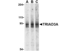 Image no. 1 for anti-Ring Finger Protein 216 (RNF216) (Isoform 1), (N-Term) antibody (ABIN265155) (RNF216 Antikörper  (Isoform 1, N-Term))