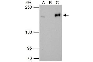 IP Image Topoisomerase II beta antibody immunoprecipitates Topoisomerase II beta protein in IP experiments.