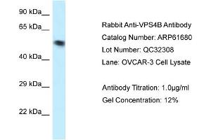 Western Blotting (WB) image for anti-Vacuolar Protein Sorting 4 Homolog B (vps4b) (N-Term) antibody (ABIN2774320) (VPS4B Antikörper  (N-Term))