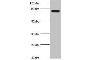 Western blot All lanes: Peroxisomal multifunctional enzyme type 2 antibody at 3 μg/mL + Mouse liver tissue Secondary Goat polyclonal to rabbit IgG at 1/10000 dilution Predicted band size: 80, 84, 78 kDa Observed band size: 80 kDa (HSD17B4 Antikörper  (AA 437-736))