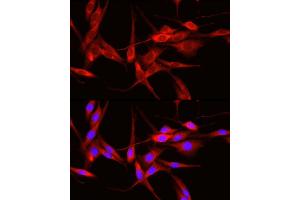 Immunofluorescence analysis of PC-12 cells using  Rabbit pAb (ABIN6131155, ABIN6136539, ABIN6136540 and ABIN6221035) at dilution of 1:50 (40x lens). (ADAM9 Antikörper  (AA 475-685))