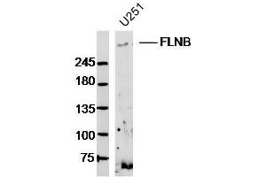 U251 lysates probed with FLNB Polyclonal Antibody, Unconjugated  at 1:300 dilution and 4˚C overnight incubation.