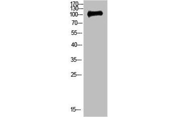 CTNND1 Antikörper  (AA 841-890)