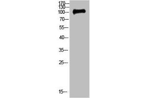 Western Blot analysis of 3T3 cells using Antibody diluted at 500. (CTNND1 Antikörper  (AA 841-890))
