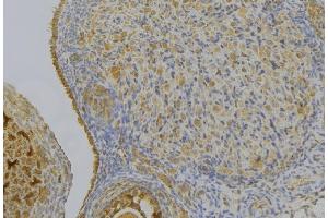 ABIN6276997 at 1/100 staining Human gastric tissue by IHC-P. (HSD17B2 Antikörper  (C-Term))
