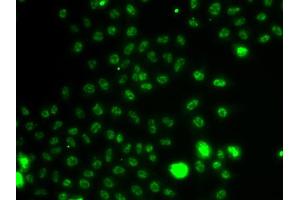 Immunofluorescence analysis of A549 cells using ETV1 antibody. (ETV1 Antikörper)