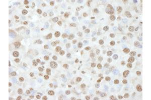 Immunohistochemistry (IHC) image for anti-Nuclear Casein Kinase and Cyclin-Dependent Kinase Substrate 1 (NUCKS1) (AA 1-50) antibody (ABIN7448993) (NUCKS1 Antikörper  (AA 1-50))