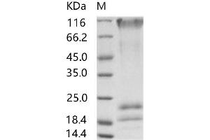 Western Blotting (WB) image for Sudan Ebola Virus Envelope Glycoprotein (SEBOV GP) protein (His tag) (ABIN7198919) (SEBOV GP Protein (His tag))