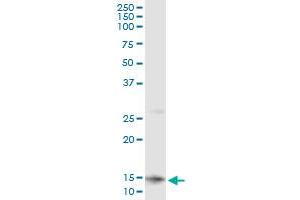 CLPS (Human) IP-WB Antibody Pair
