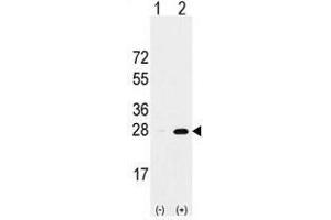 Image no. 1 for anti-Proteasome Subunit alpha 5 (PSMA5) (Middle Region) antibody (ABIN356946) (PSMA5 Antikörper  (Middle Region))