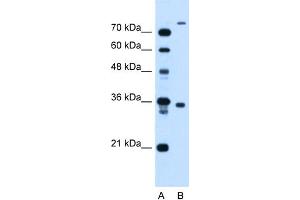 WB Suggested Anti-FLJ22167 Antibody Titration:  1. (FLJ22167 (N-Term) Antikörper)