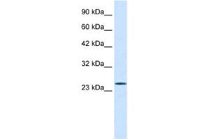 WB Suggested Anti-PCGF3 Antibody Titration:  0. (PCGF3 Antikörper  (Middle Region))